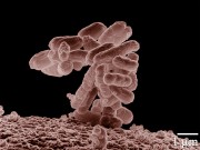Colonie d'Escherichia coli