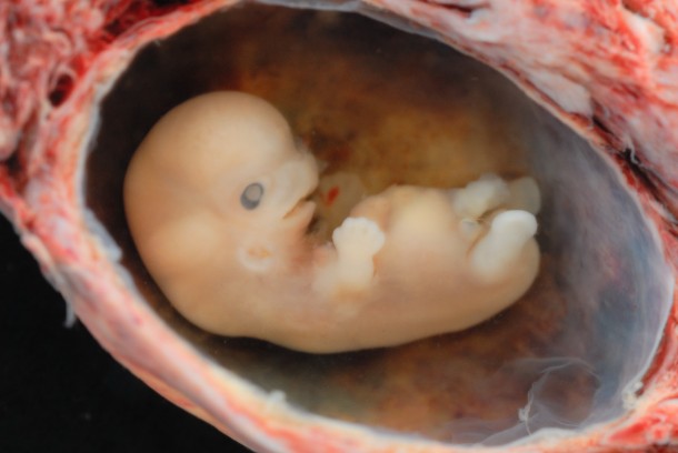 Embryon Humain