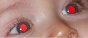 Yeux rouges